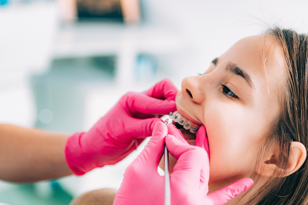 Orthodontics for Kids and Teens in Huntington Beach